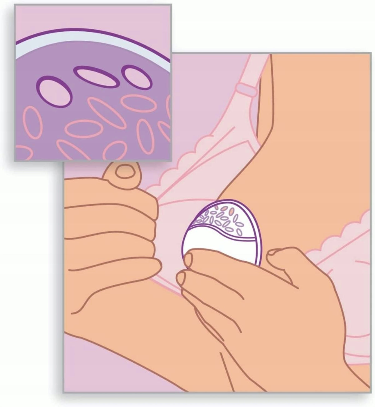 PHILIPS AVENT muszle laktacyjne ochronne