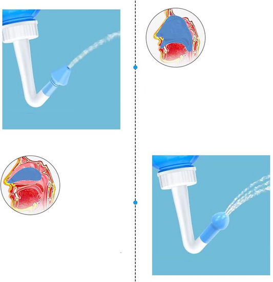 HOUDIAN Neti Pot neusirrigator voor kinderen en volwassenen 2 opzetstukken 300 ml